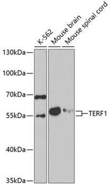 Anti-TERF1 Antibody (CAB5293)