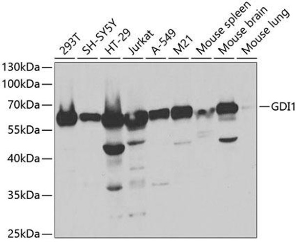 Anti-GDI1 Antibody (CAB5462)