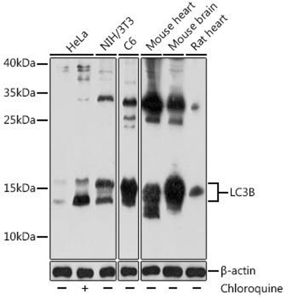Anti-LC3B Antibody (CAB5601)