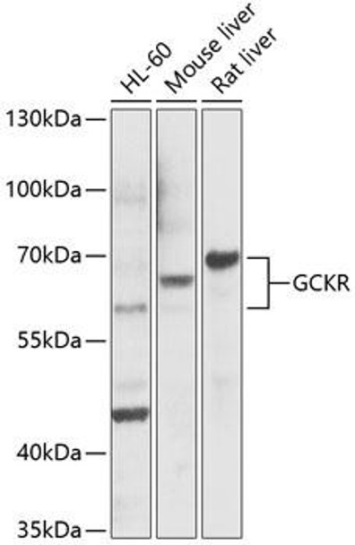 Anti-GCKR Antibody (CAB5678)