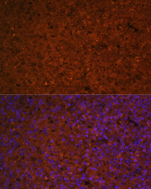 Anti-SLAMF7 Antibody (CAB5782)