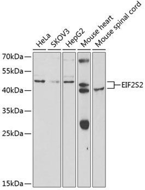 Anti-EIF2S2 Antibody (CAB5894)