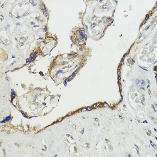 Anti-HACE1 Antibody (CAB9593)