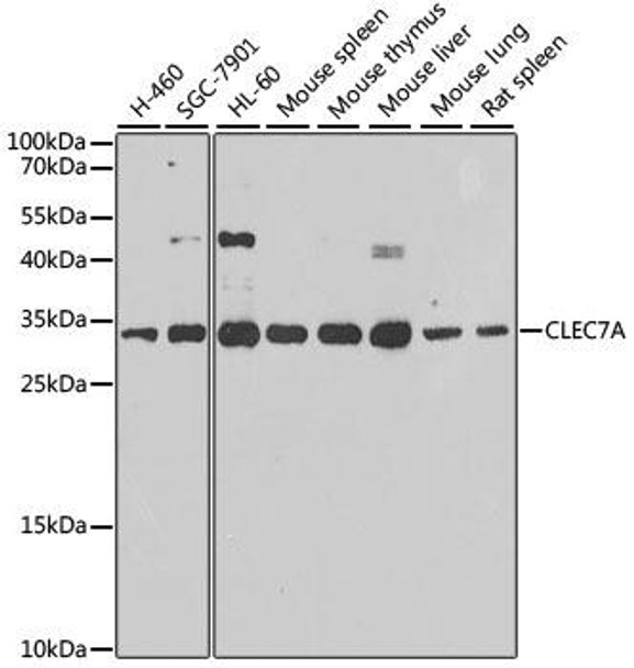 Anti-CLEC7A Antibody (CAB9883)