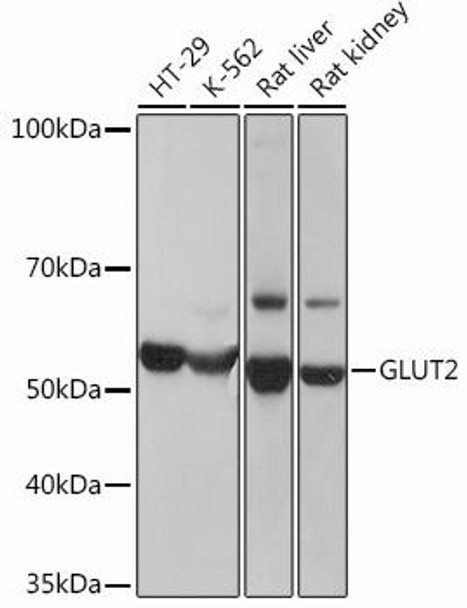 Anti-GLUT2 Antibody (CAB12307)