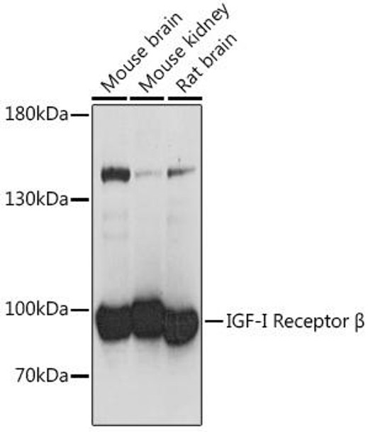 Anti-IGF1R Antibody (CAB16884)