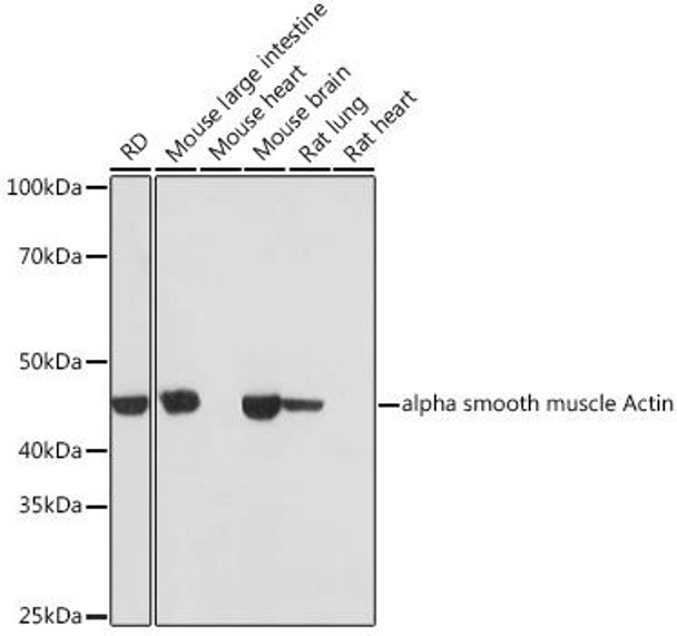 Anti-alpha smooth muscle Actin Antibody (CAB17910)