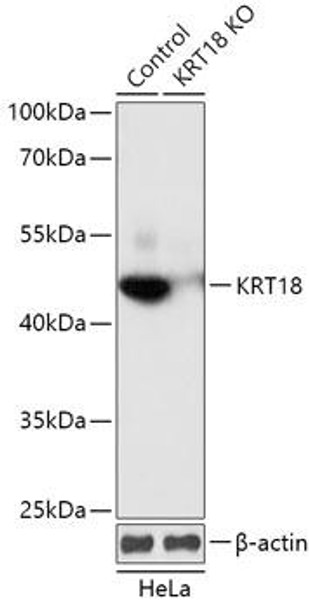 Anti-KRT18 Antibody (CAB18010)[KO Validated]