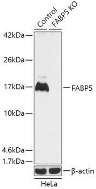 Anti-FABP5 Antibody (CAB18087)[KO Validated]