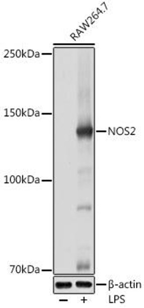 Anti-NOS2 Antibody (CAB18247)