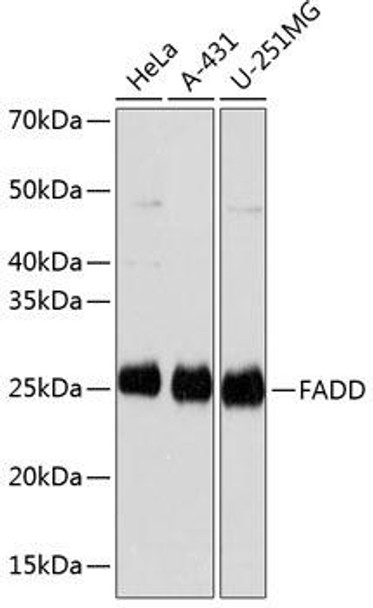 Anti-FADD Antibody (CAB19049)