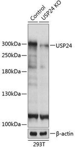 Anti-USP24 Antibody (CAB20003)[KO Validated]