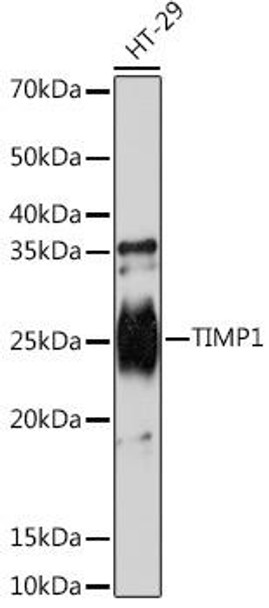 Anti-TIMP1 Antibody (CAB4959)