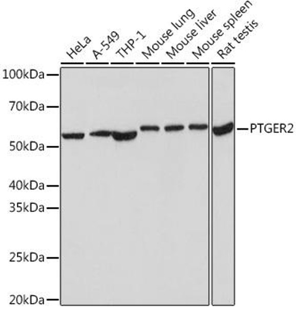 Anti-PTGER2 Antibody (CAB9053)