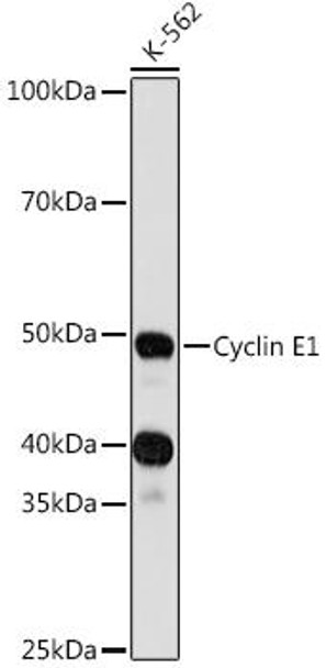 Anti-Cyclin E1 Antibody (CAB12000)