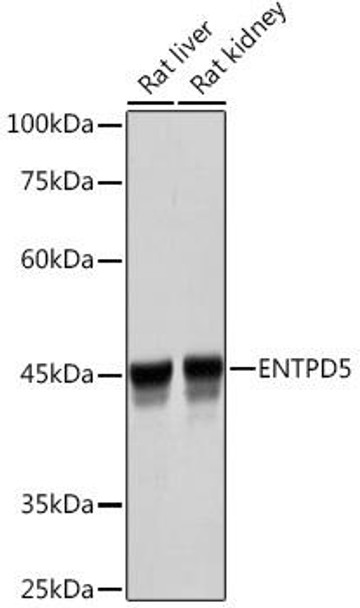 Anti-ENTPD5 Antibody (CAB19647)