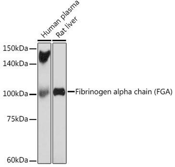 Anti-Fibrinogen alpha chain (FGA) Antibody (CAB19658)