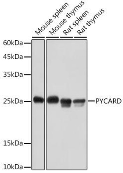 Anti-PYCARD Antibody (CAB20484)