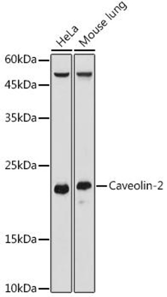 Anti-Caveolin-2 Antibody (CAB20549)