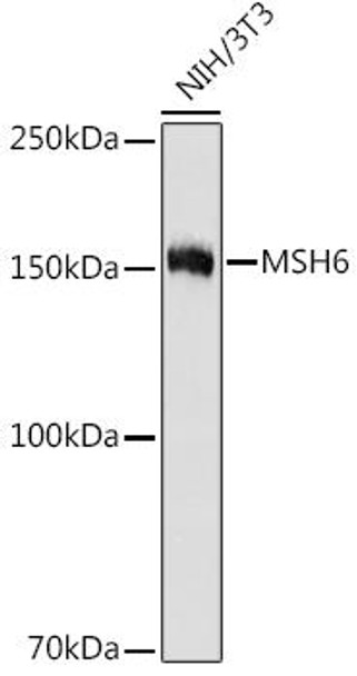 Anti-MSH6 Antibody (CAB8795)