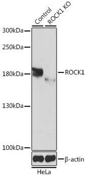 Anti-ROCK1 Antibody (CAB1008)[KO Validated]