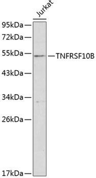 Anti-TNFRSF10B Antibody (CAB1236)