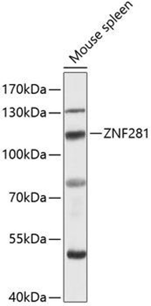 Anti-ZNF281 Antibody (CAB12650)