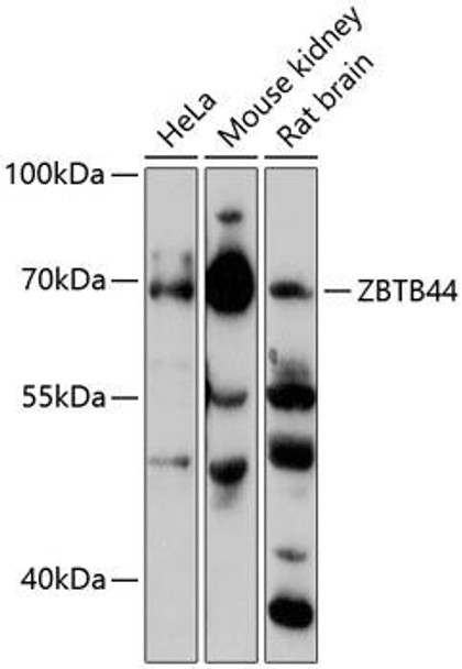 Anti-ZBTB44 Antibody (CAB13148)