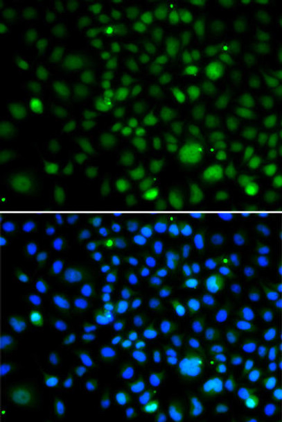 Anti-KLF15 Antibody (CAB13420)