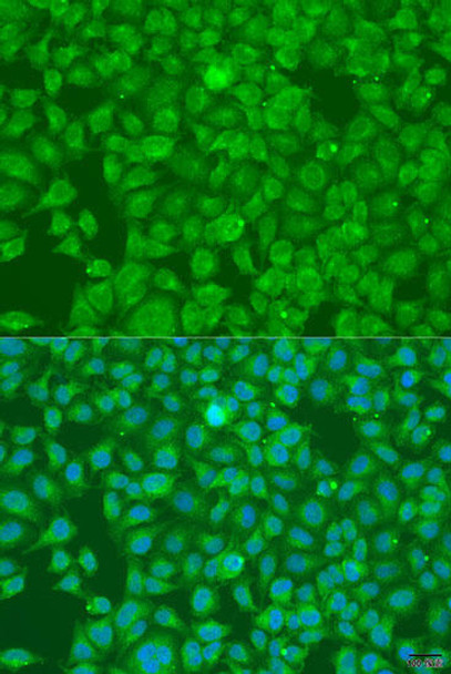 Anti-SLC25A6 Antibody (CAB15029)