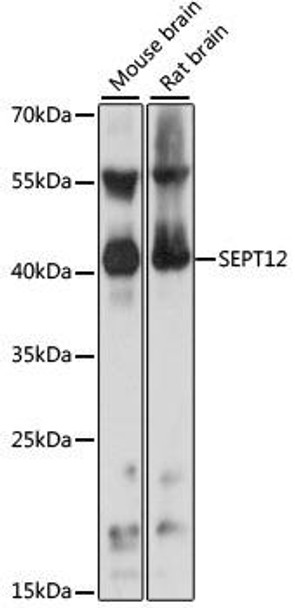 Anti-SEPT12 Antibody (CAB15564)