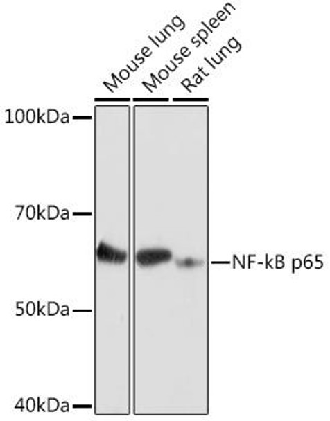 Anti-NF-kB p65 Antibody (CAB16271)