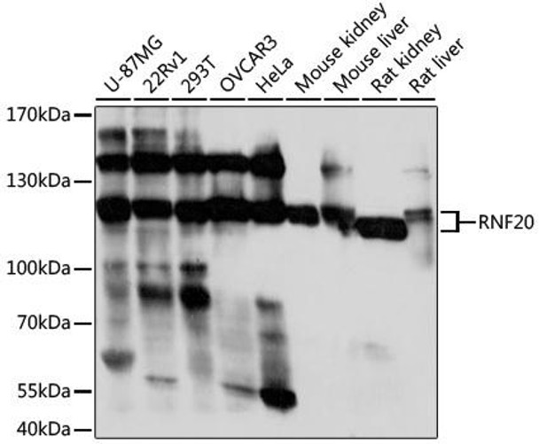 Anti-RNF20 Antibody (CAB17309)