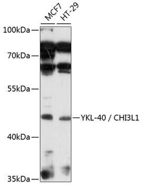 Anti-YKL-40 / CHI3L1 Antibody (CAB3166)
