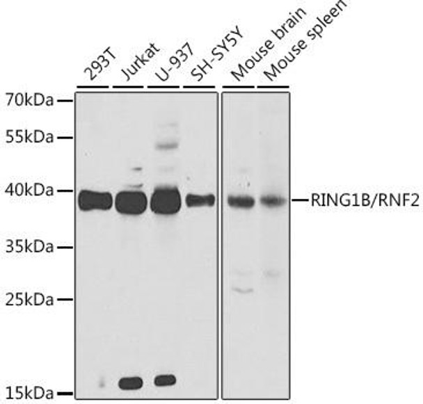 Anti-RING1B/RNF2 Antibody (CAB5563)