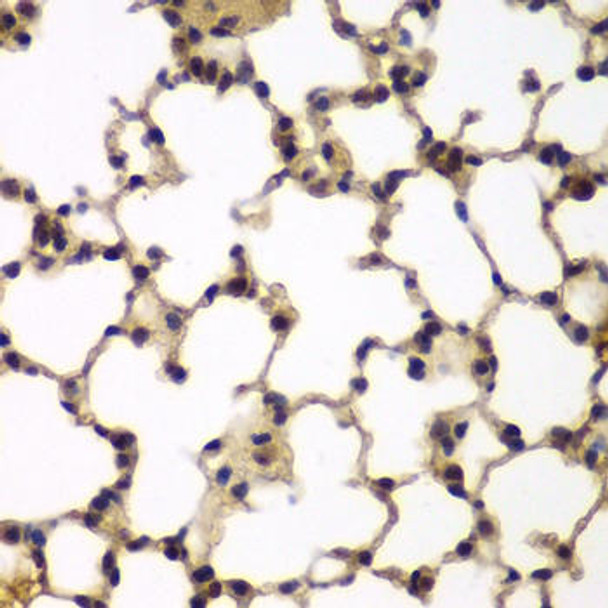 Anti-E2F6 Antibody (CAB6151)