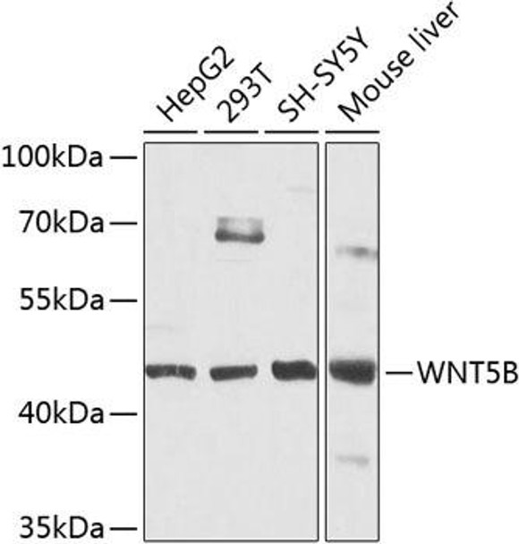 Anti-Protein Wnt-5b Antibody (CAB8313)