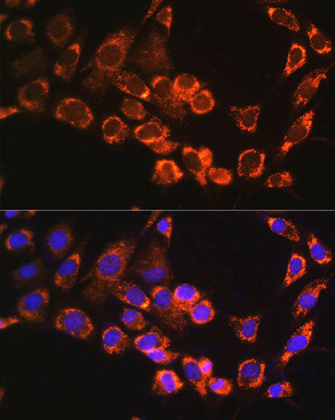 Anti-TRIM23 Antibody (CAB8329)