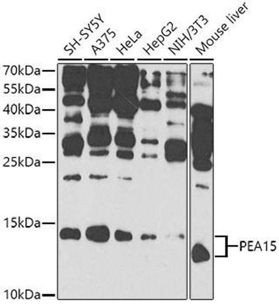 Anti-PEA15 Antibody (CAB9956)