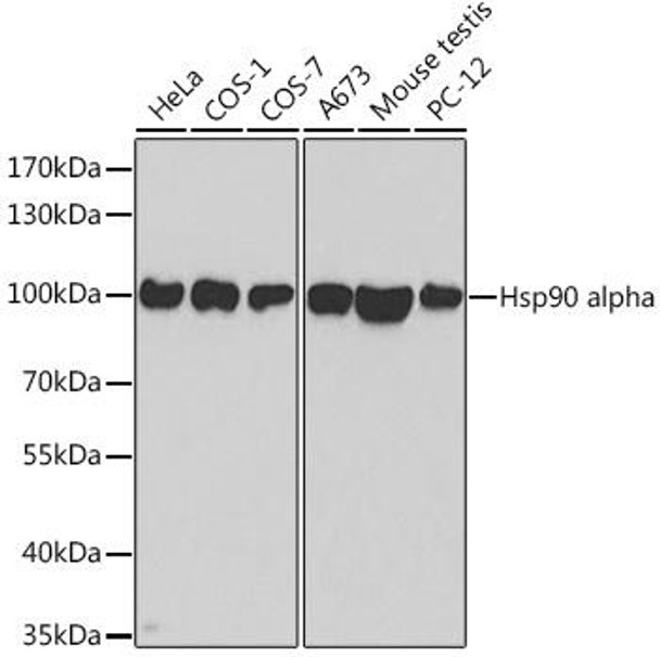 Anti-Hsp90 alpha Antibody (CAB0365)