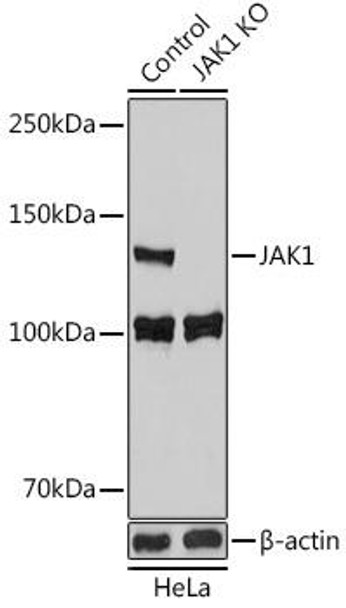 Anti-JAK1 Antibody (CAB18323)[KO Validated]