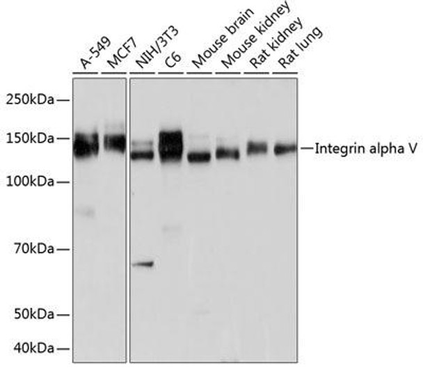 Anti-Integrin alpha V Antibody (CAB19071)