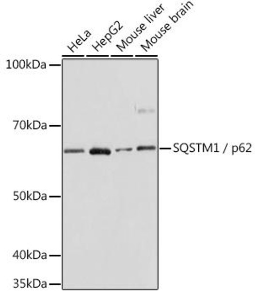 Anti-SQSTM1 / p62 Antibody [KO Validated] (CAB19700)