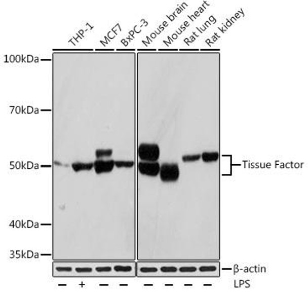 Anti-Tissue Factor Antibody (CAB4395)