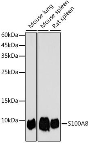 Anti-S100A8 Antibody (CAB20474)