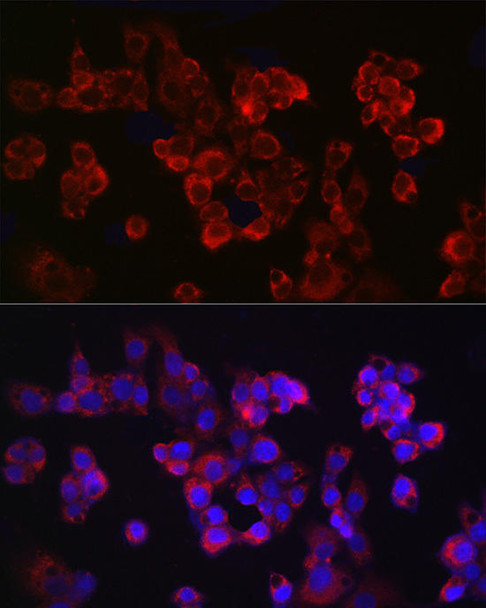 Anti-APP Antibody (CAB20508)