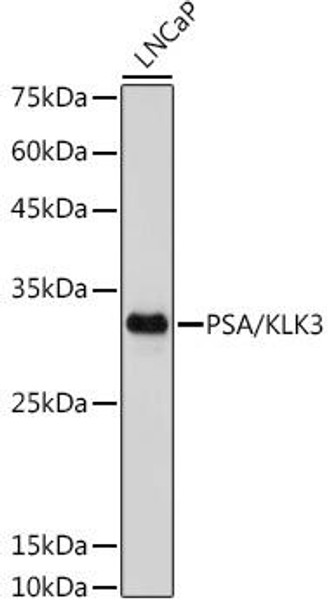 Anti-PSA/KLK3 Antibody (CAB4355)