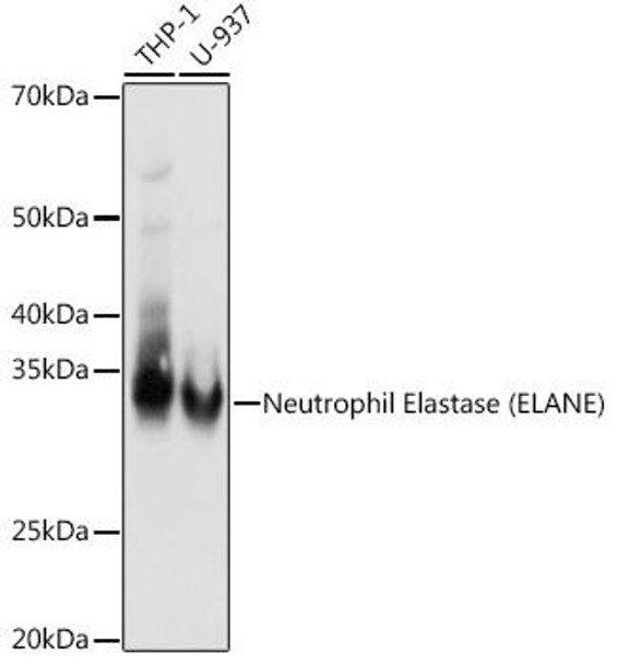 Anti-Neutrophil Elastase (ELANE) Antibody (CAB8953)