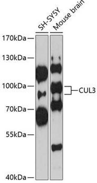 Anti-CUL3 Antibody (CAB1078)