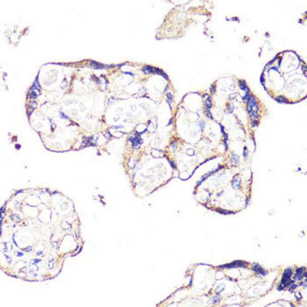 Anti-IGF2R Antibody (CAB13022)